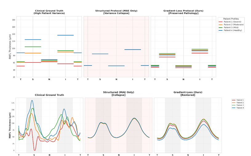 MLP Regression Result - Mean Population Claim